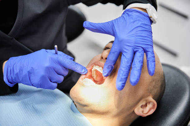 Best Emergency Dental Care for Sports Injuries in Ferriday, LA