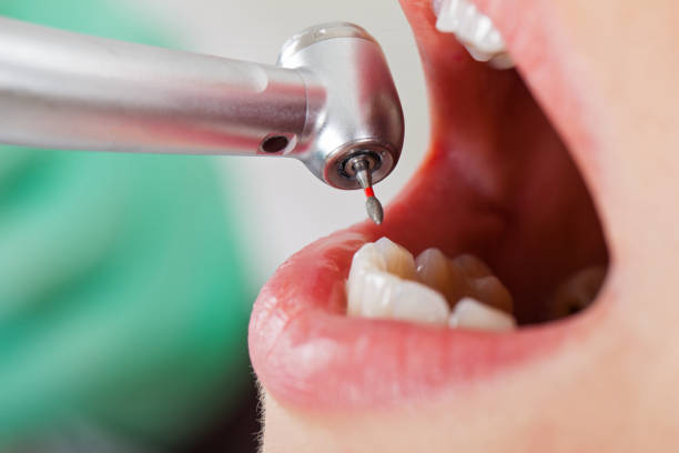 Best Emergency Dental Care for Sports Injuries in Ferriday, LA
